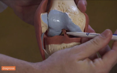 screen-telebasel-diagnose03