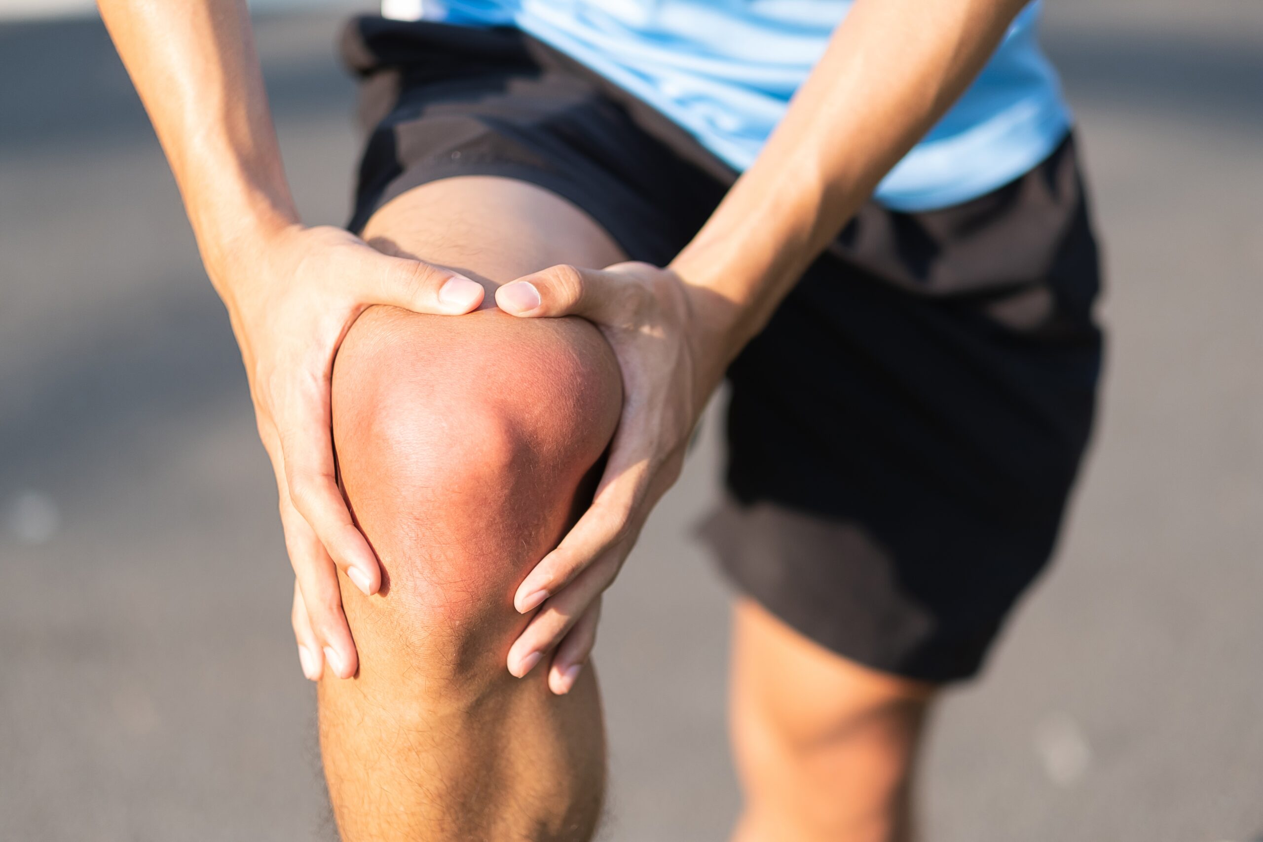 patella instabilität
